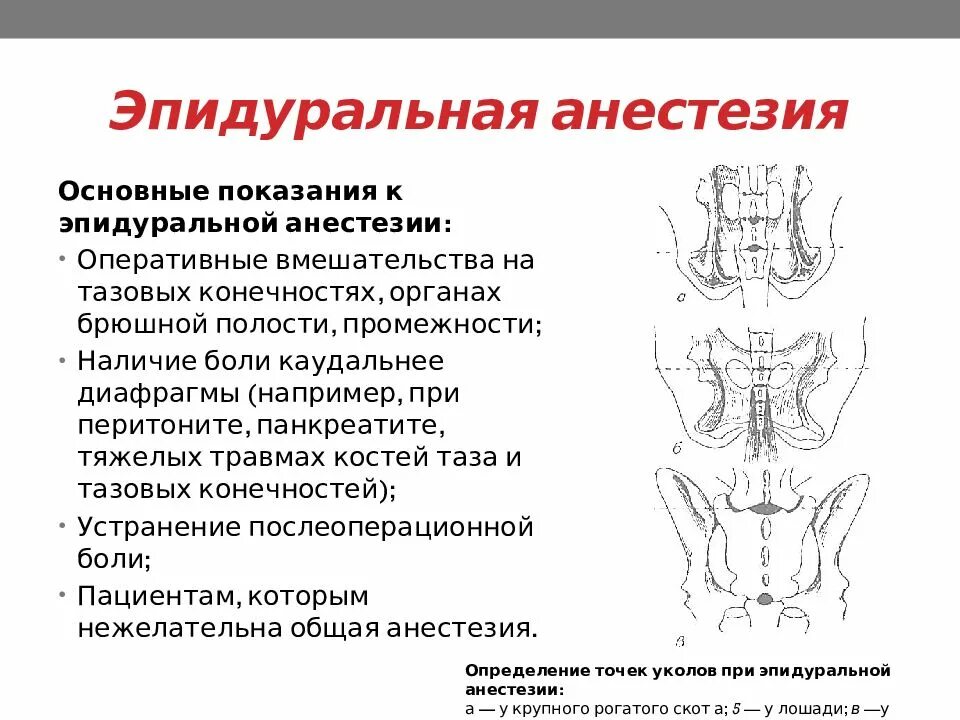 Проведение эпидуральной анестезии. Показания к эпидуральной анестезии. эпидуральная анестезия показания. эпидуральная и перидуральная анестезия. показания и противопоказания к эпидуральной анестезии.