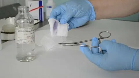 Положительная азопирамовая проба на скрытую