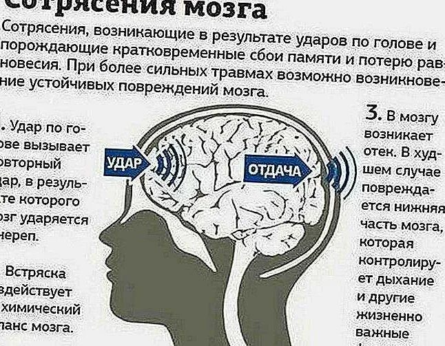 Как распознать сотрясение у ребенка. Основной симптом сотрясения мозга. симптомы сотрясения головного мозга у ребенка 8 лет. симптомы сотрясения головного мозга у ребенка 6 лет. сотрясение головного мозга симптомы у ребенка 7 лет.