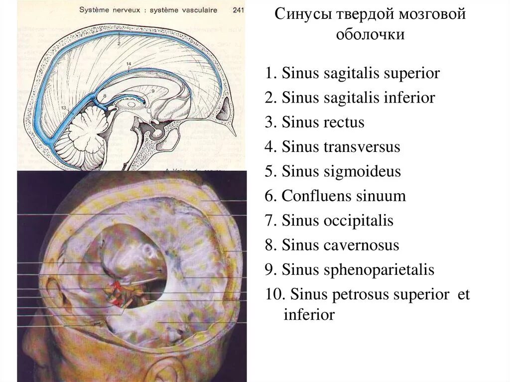 Синусы твердой оболочки мозга. Оболочки мозга. Синусы твердой мозговой оболочки. Пещеристый синус твердой мозговой оболочки. 6 Синусов твердой оболочки. Синусы головного мозга анатомия.
