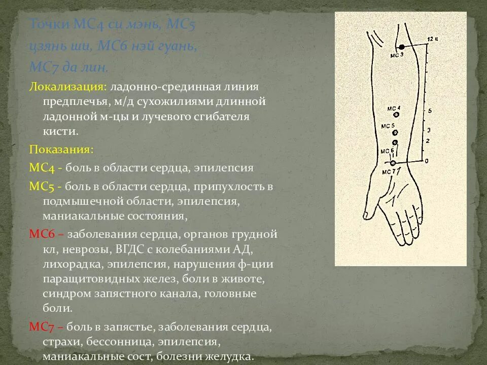 Точка мс 8. Mc6 Нэй-Гуань точка акупунктуры. Точка МС 5 Цзянь ши. МС 5 точка акупунктуры. Точка mc5.