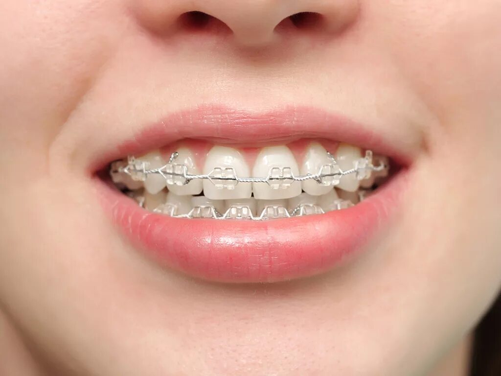 Со скольки лет ставят зубы. Порядок прорезывания постоянных зубов схема. Со скольки лет ставят зубы. Схема прорезывания зубов у детей до 3 лет порядок. Детские элайнеры.