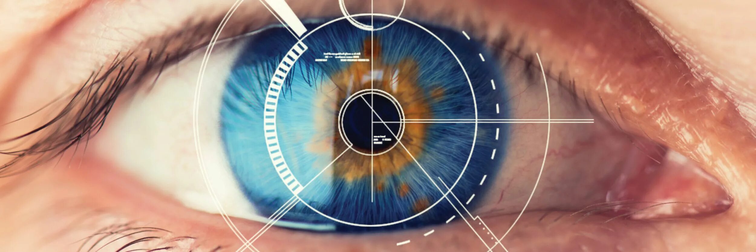 Аналитическое зрение. Сетчатка глаза биометрия. Сканер по радужной оболочке глаза. Коррекция зрения лазером.