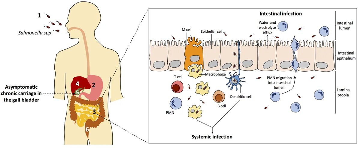 Патогенез сальмонеллеза схема. Salmonella enterica патогенез. Патогенез шигеллеза. Механизм заражения сальмонеллезом схема. Механизм сальмонеллеза