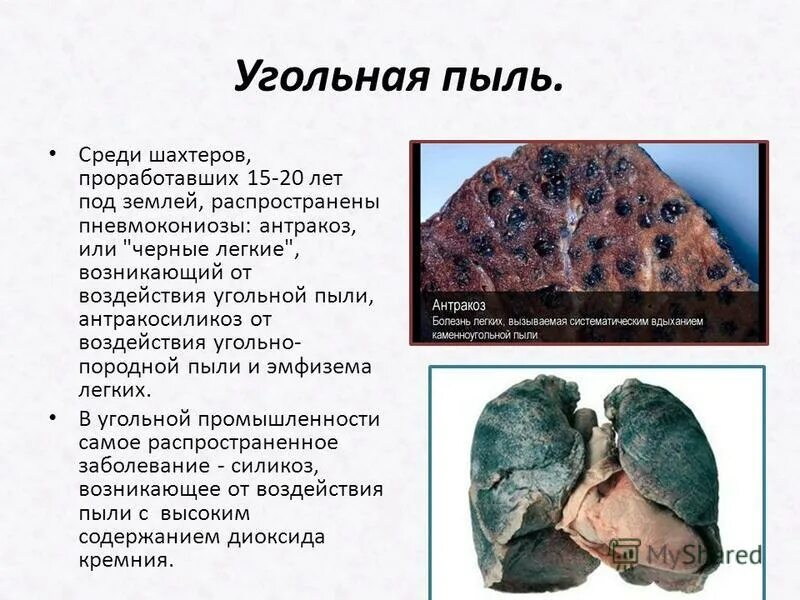 Перечень профессиональных заболеваний. Профессиональная болезнь шахтеров. Профессиональная болезнь это в гигиене. Болезнь легких силикоз. Профессиональные вредности шахтеров.