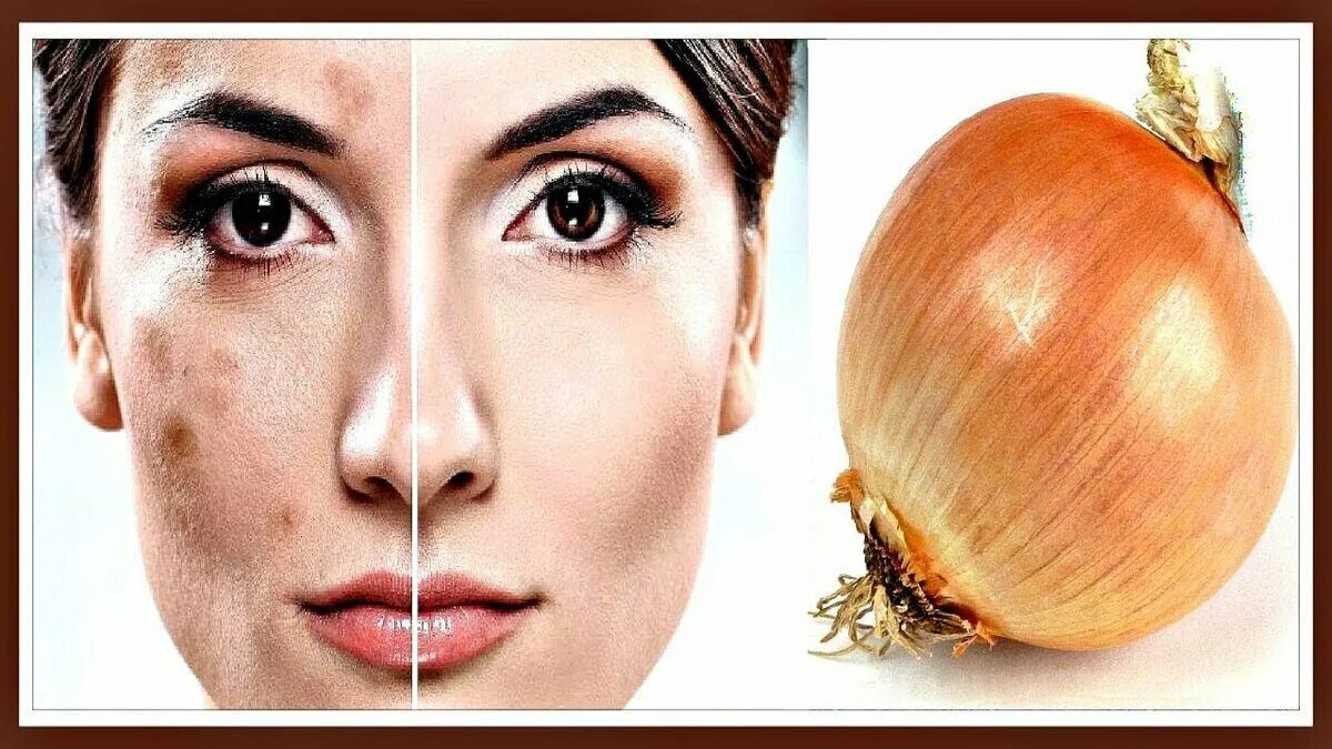 Луковое лицо. Человек ест лук. Девушка в маске для лица. Маска для лица с луком. Луковое лицо.