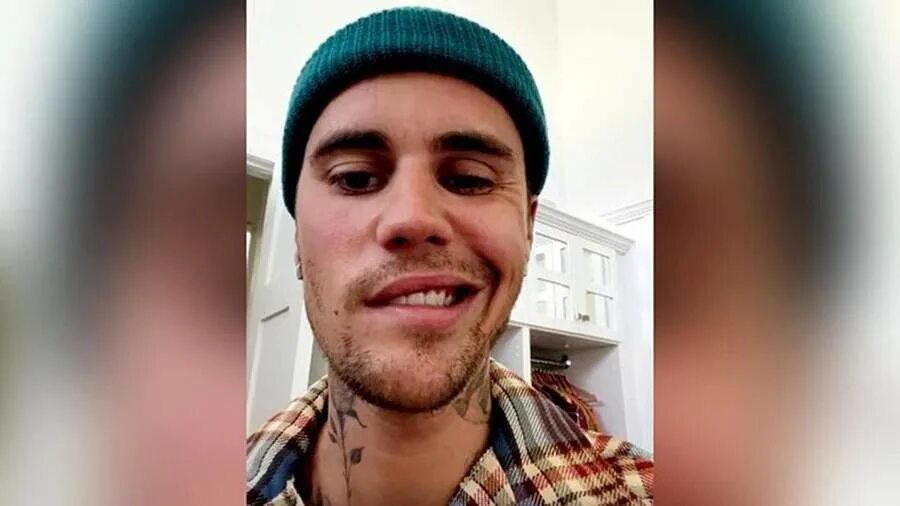 Justin Bieber revela que padece la enfermedad de Lyme y preocupa a sus fans - Yo