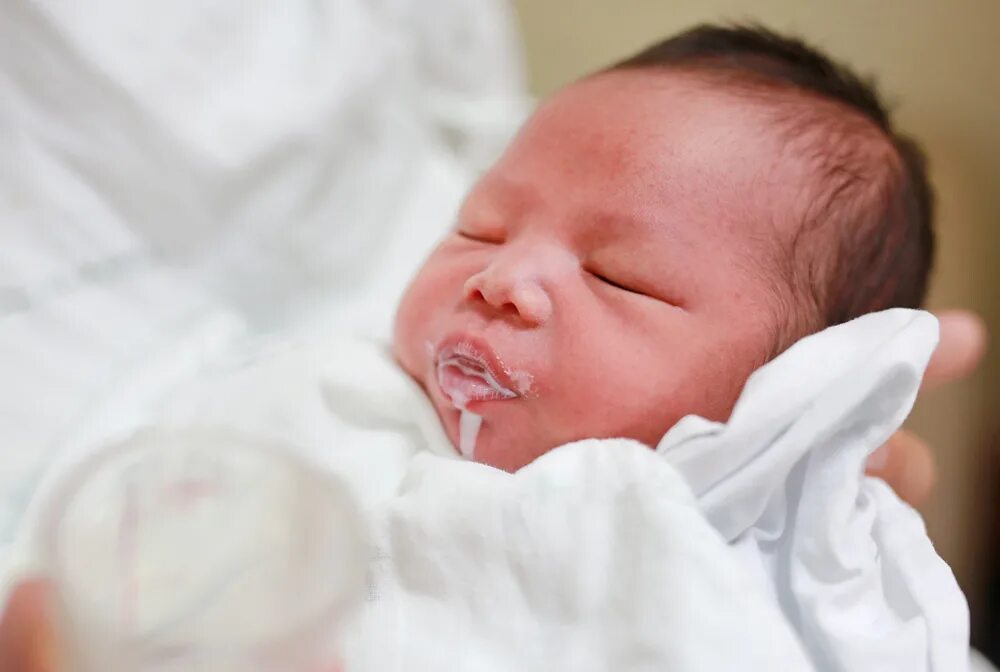Почему новорожденный срыгивает после кормления фонтаном. Срыгивание у новорожденных. Галактоземия фото новорожденного. Рвота и срыгивание у грудничка. Срыгивает новорожденный.