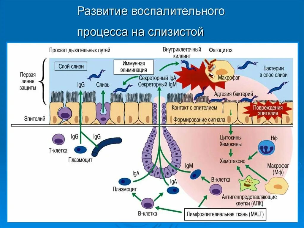 Иммунная система бактерий. Стадии воспалительного процесса схема. Схема развития воспалительного иммунного ответа. Механизм воспалительного процесса схема. Схема патогенеза воспалительного процесса.