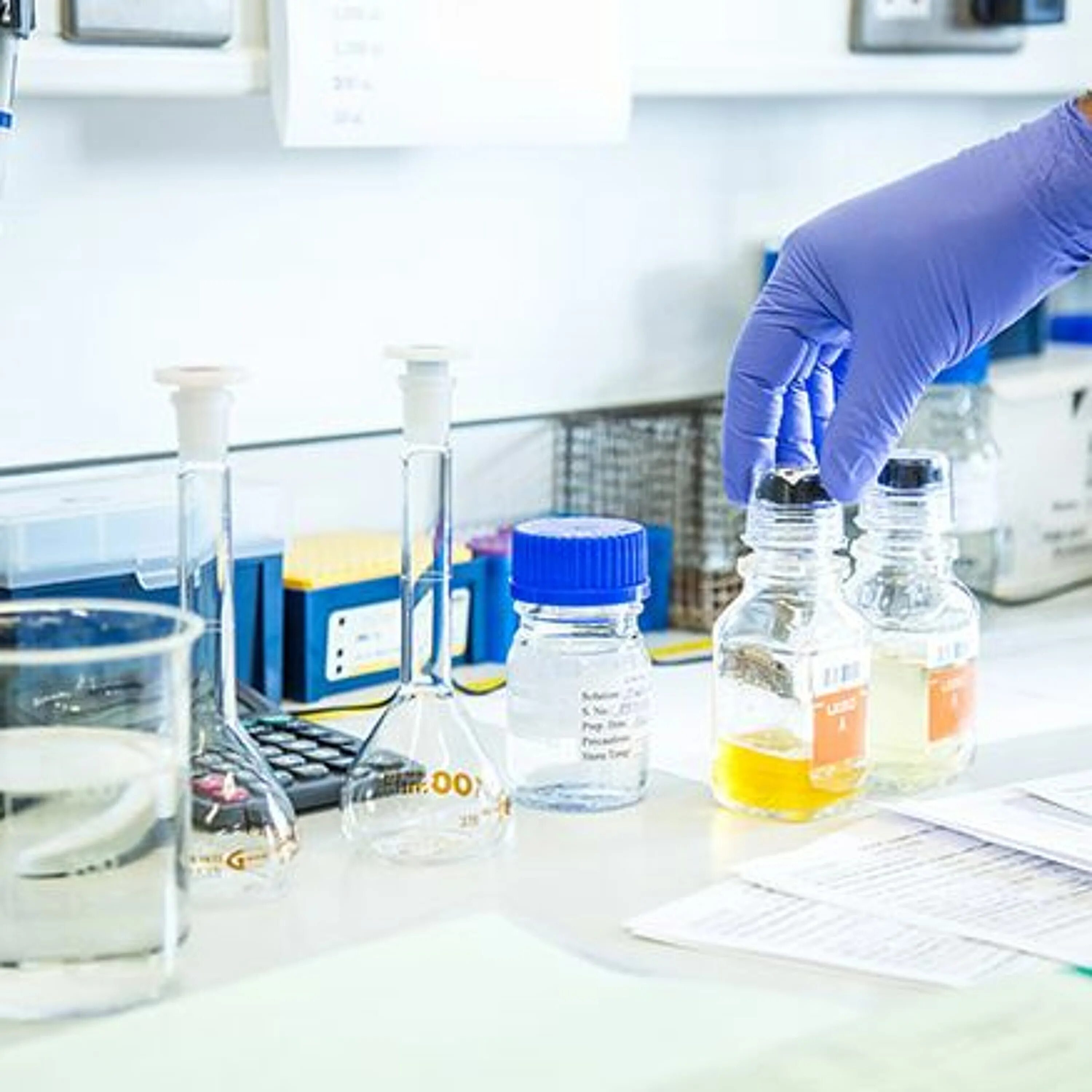 Емкость для взятия мочи на исследование по нечипоренко. Мочи лаб. Мочи лаб. Моча цвета кока колы. Полуавтоматический анализатор мочи laura erba.