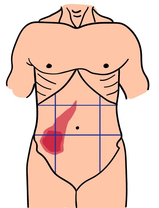 Тянет живот справа у мужчин. Болит верх живота. Локализация боли в животе в картинках. Верхняя часть живота. Болит живот сверху.