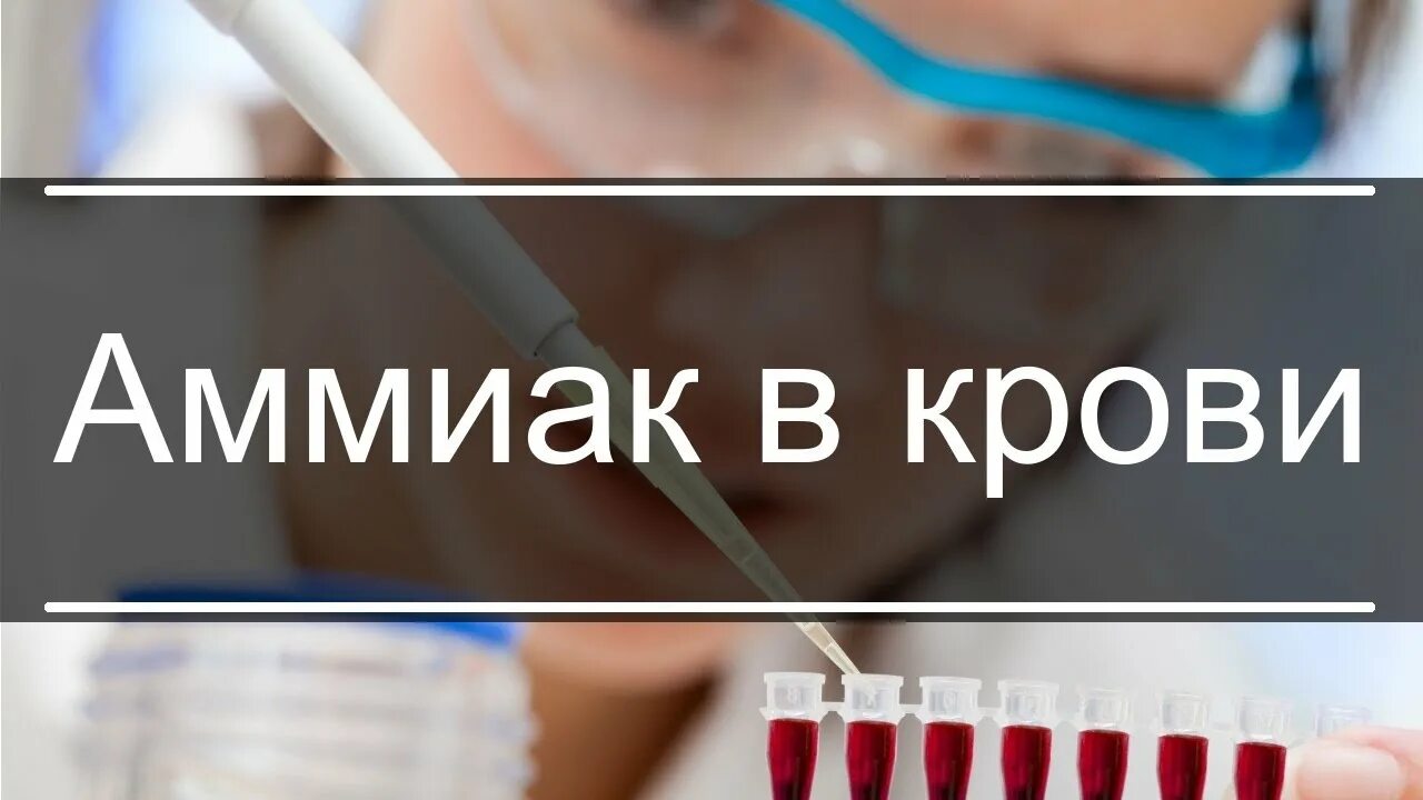 Норма аммиака в крови. Аммиак в крови анализ. Уровень аммиака в крови норма. Аммиак в крови повышен. Анализ на аммиак в крови