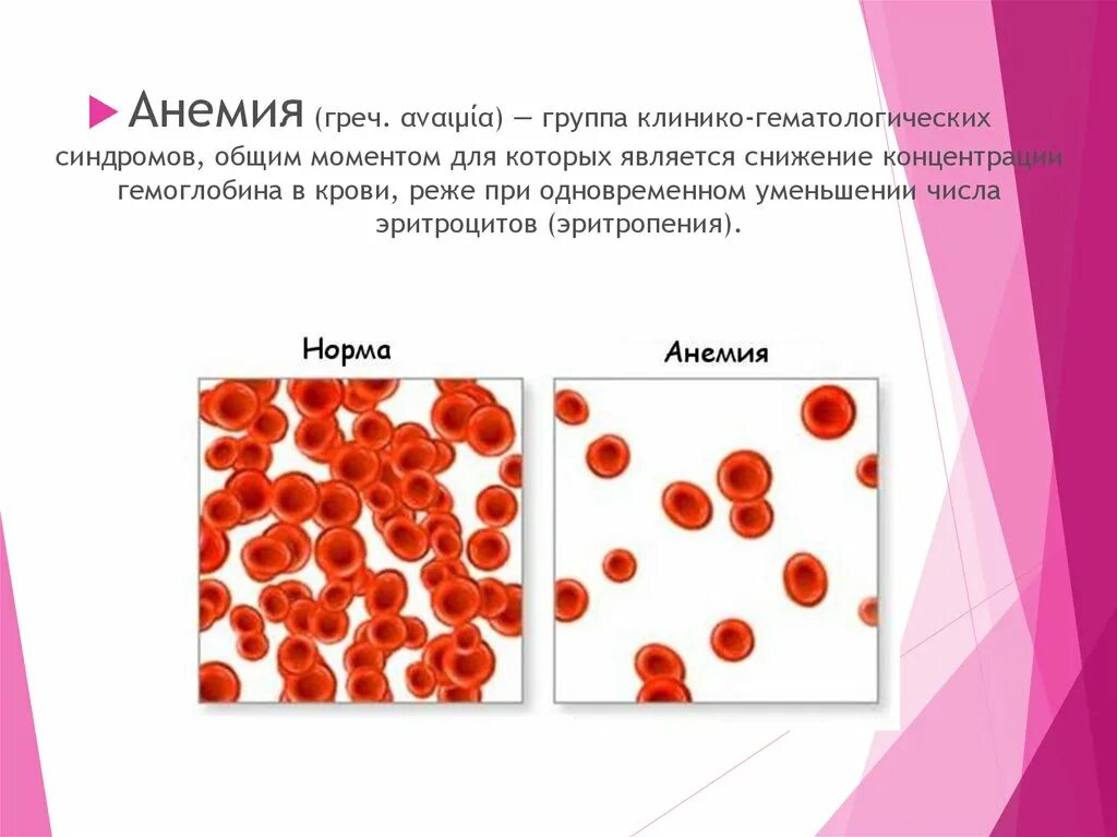 Малокровие эритроцитов. Снижение гемоглабинав кров. Анемия эритроциты. Снижение эритроцитов и гемоглобина в крови.