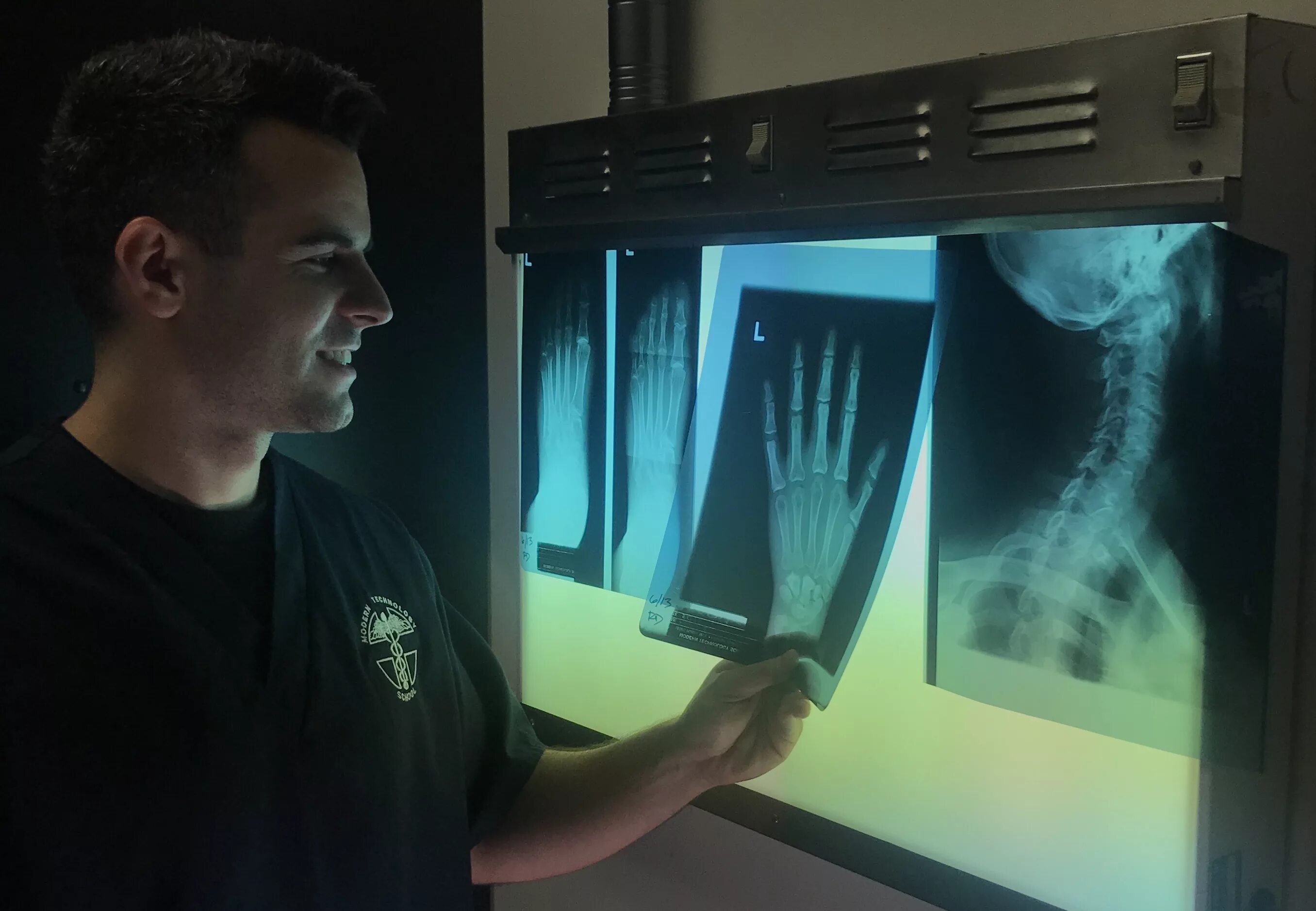 D a xray monolith. X-ray Diagnostic. Рентген. Рентген лучи. Рентгеновское изображение.