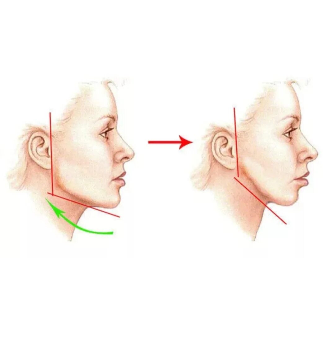 Лоб опускается. Угол молодости на лице. Углы нижней трети лица. Угол нижней челюсти.
