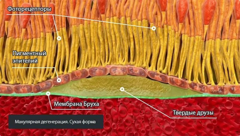 Макула и задний полюс