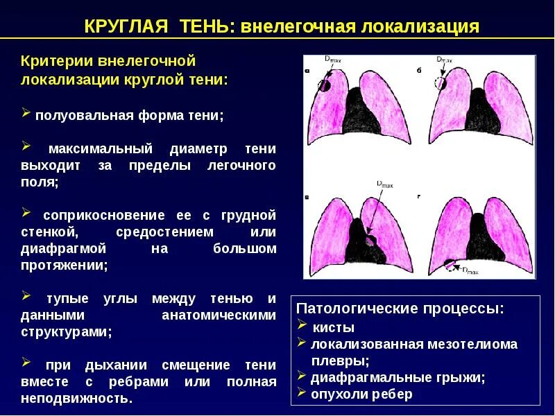 Патологические тени