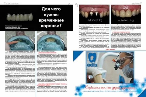 Прямой метод изготовления коронок