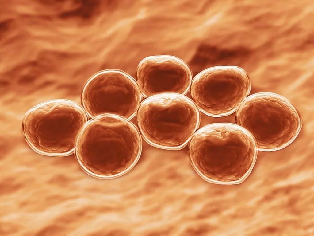 Золотистая инфекция. Золотистый стафилококк MRSA. Метициллин бактерия. Метициллин-резистентный золотистый стафилококк. Золотистый стафилококк под микроскопом.