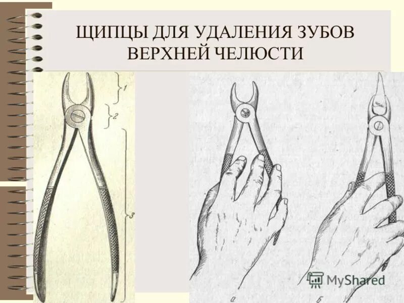 Какими щипцами удаляют зубы