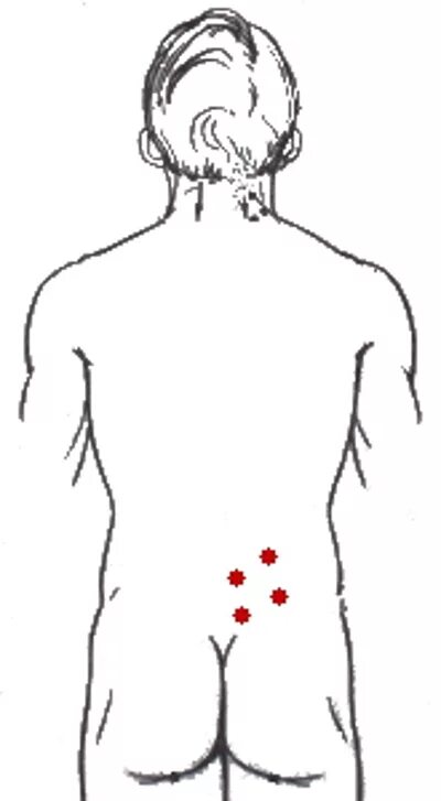 Точки на пояснице. Самомассаж триггерных точек поясницы. Точечный массаж для расслабления мышц спины. Шиацу массаж точки воздействия поясница. Точки на спине.