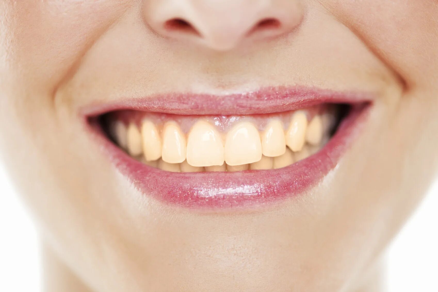 Smile design