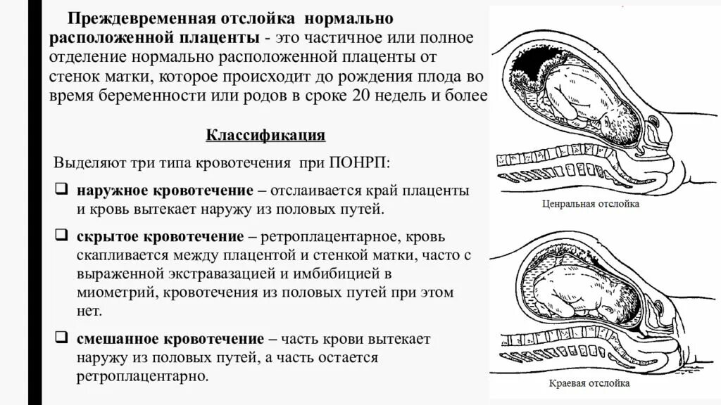 Ретроплацентарная отслойка плаценты. Отслойка нормально расположенной плаценты симптомы. Преждевременная отслойка плаценты симптомы. Осложнения при отслойке плаценты. Кровь после акта при беременности