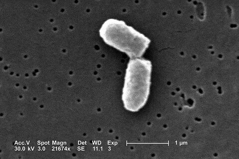 E coli типичные