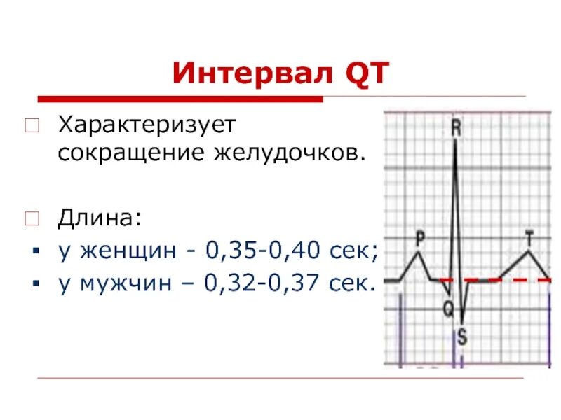 Удлинение интервала qt на экг. Удлиненный интервал qt на экг что это такое. норма qt на экг у детей. qtc на экг.