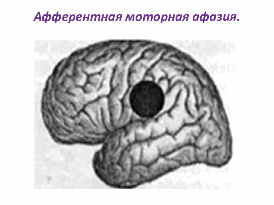 Проблема афазий