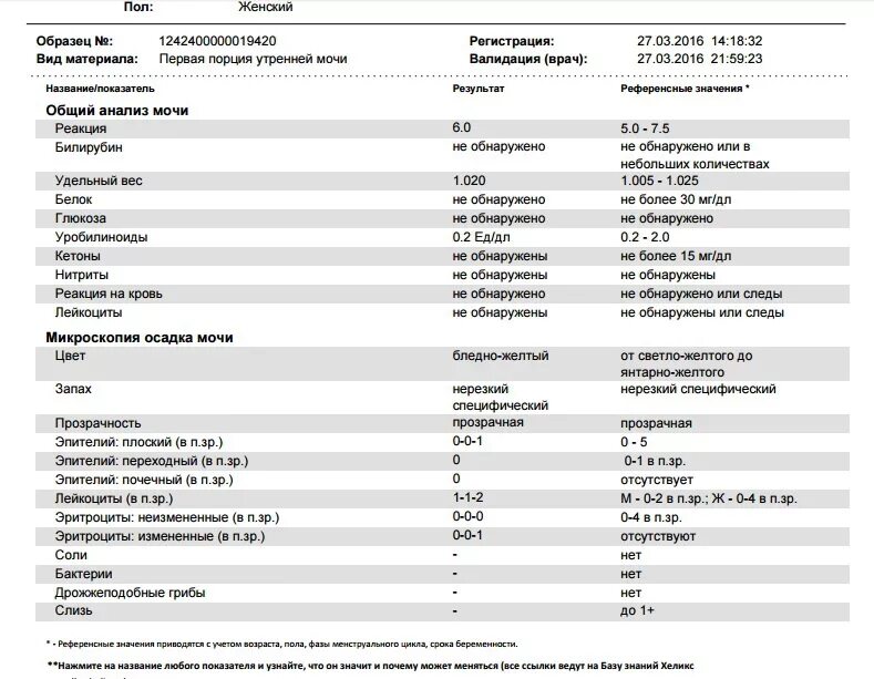 Кдл моча общий. Исследование мочи общий анализ. Общий анализ мочи Хеликс. Общий анализ мочи пример. Анализ мочи пример анализа.