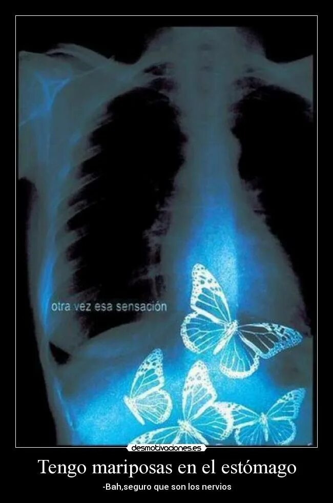 Бабочки в животе. Бабочки внутри. Рентген бабочки. Babichka v jivote. Бабочки в моем животе это любовь