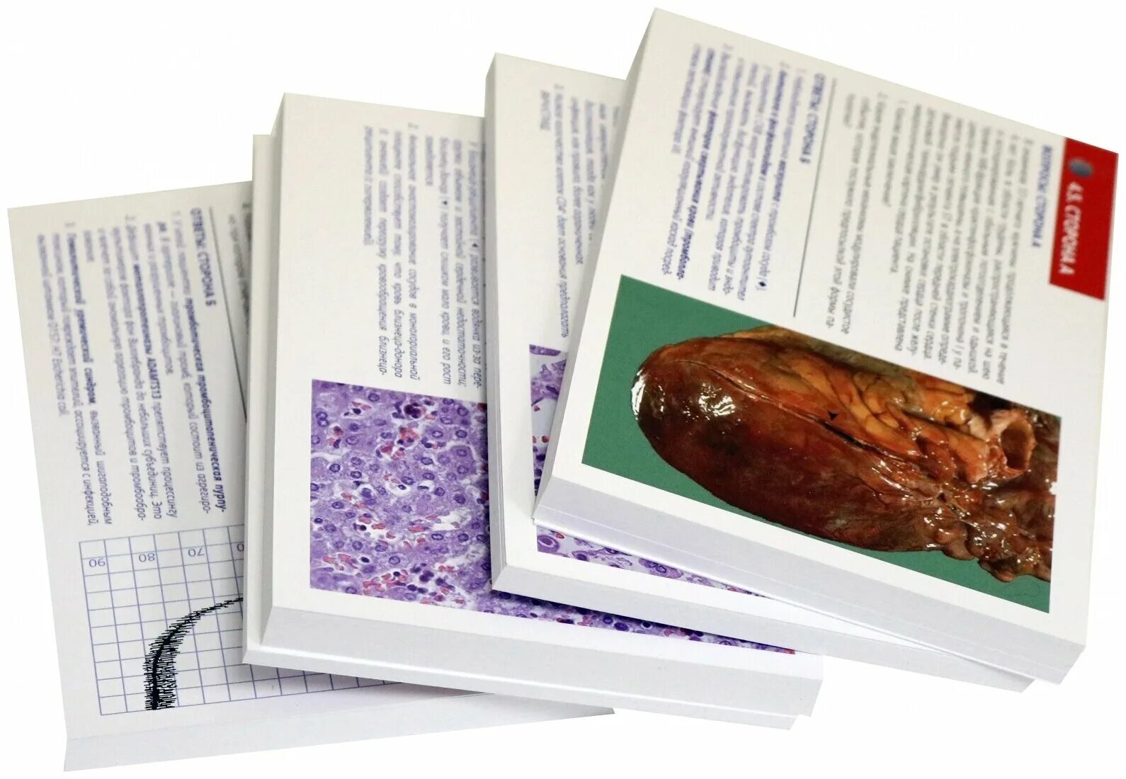 патология роббинса и котрана. "основы патологии". патология роббинса и котрана. патология по роббинсу карточки. ответы по патологии.