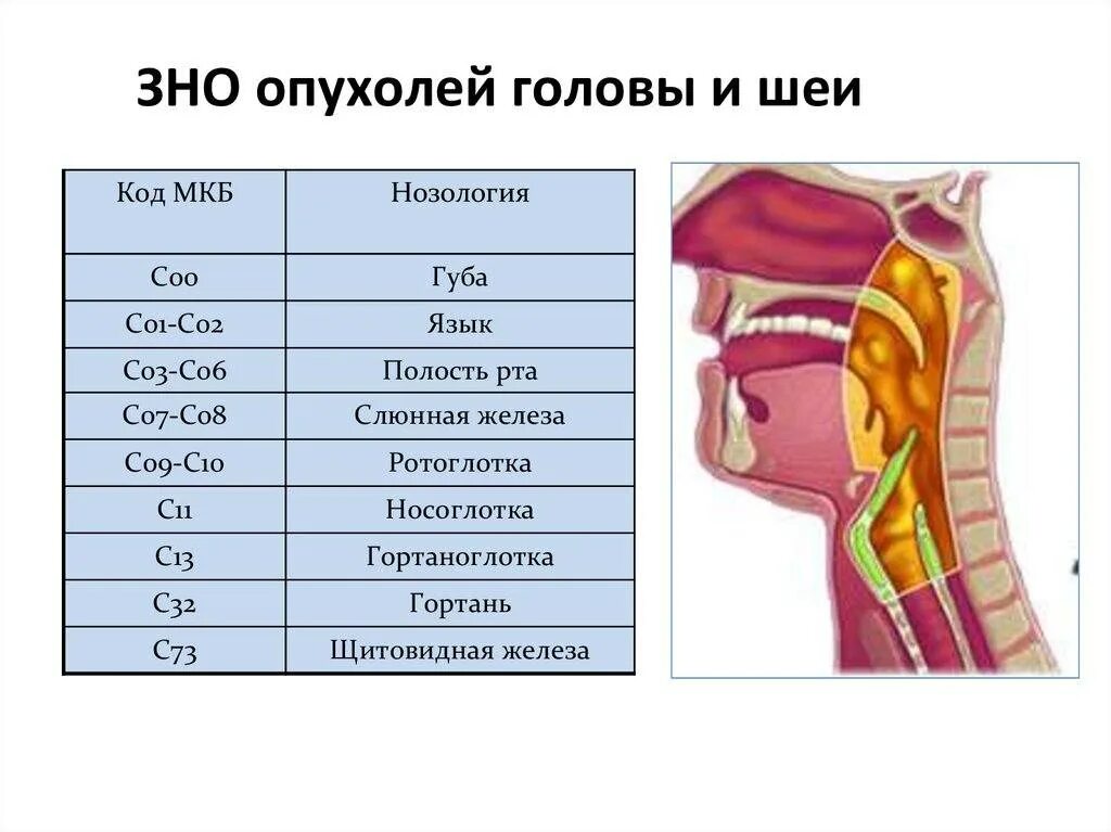 Мкб 10 объемное образование мозга. Опухоли органов головы и шеи. Злокачественные новообразования головы и шеи. Опухоли головы и шеи структура. Новообразование гортаноглотки.