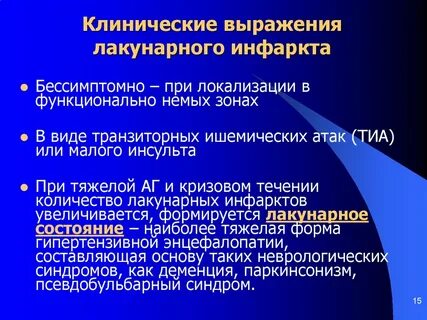 Лакунарный инфаркт