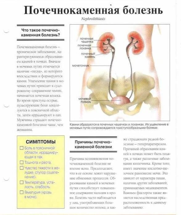 Камень больно. Профилактика мочекаменной болезни брошюра. Памятка пациенту с мочекаменной болезнью. Психосоматика болезней почек. Почечнокаменная болезнь признаки.