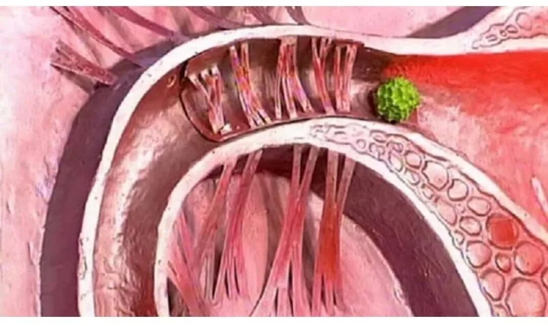 можно ли убрать спайки. можно ли убрать спайки. можно ли убрать спайки. можно ли убрать спайки. послеоперационные спайки.
