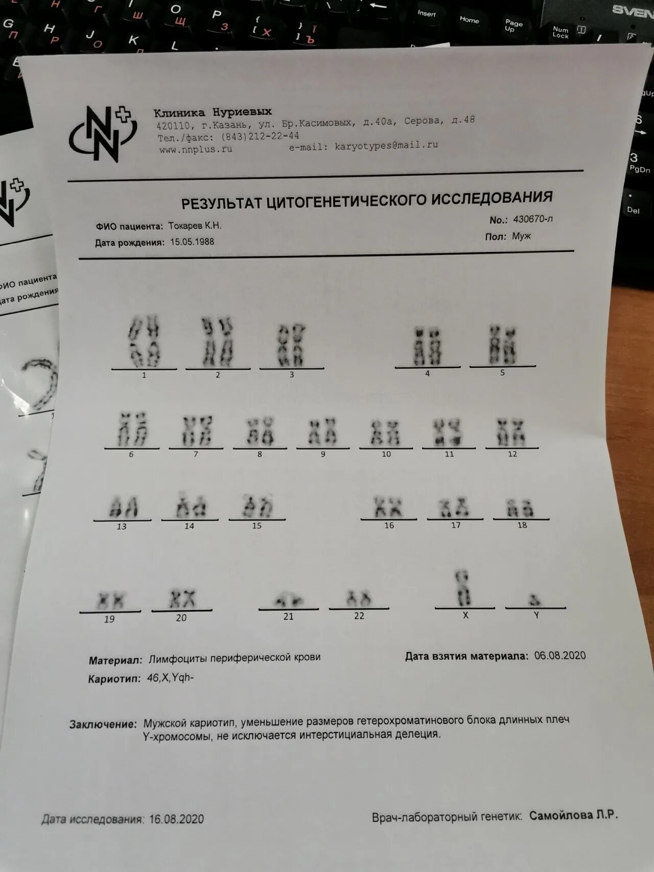 Кариотипирование супругов цена. Кариотип Результаты анализа. Анализ на кариотип заключение. Кариотипирование расшифровка анализа. Результат кариотипирования расшифровка.