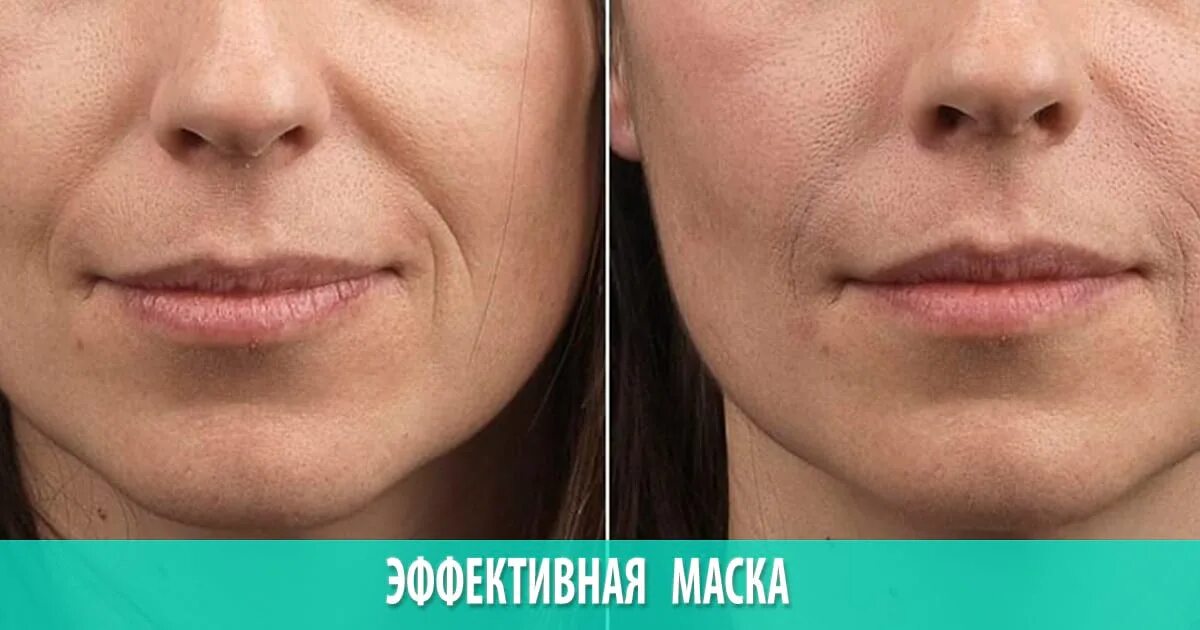 гимнастика для лица для подтяжки носогубных складок. как подтянуть носогубные складки. массаж лица от морщин носогубных складок. как подтянуть носогубные складки. упругая кожа лица.