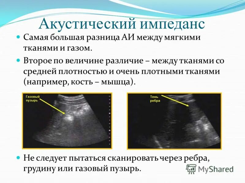 акустическая импедансометрия типы. акустический импеданс это. удельное акустическое сопротивление формула. акустический импеданс в ультразвуке. акустический импеданс это.