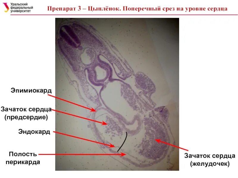 Цыпленок поперечный срез на уровне сердца. Срез сердца желудочка препарат. Срез птицы на уровне сердца. Поперечный срез на уровне клапанов сердце.