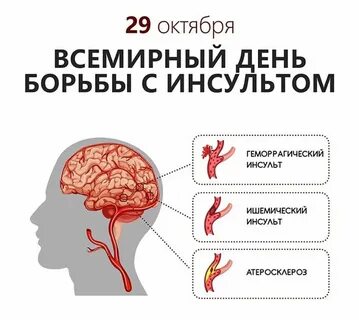 Борьба с инсультом