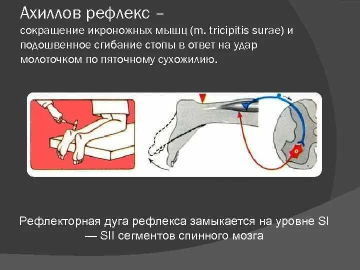 Ахиллов рефлекс рефлекторная дуга. Рефлекс ахиллова сухожилия рефлекторная дуга. Схема рефлекторной дуги ахиллова рефлекса. Схема дуги ахиллова рефлекса.