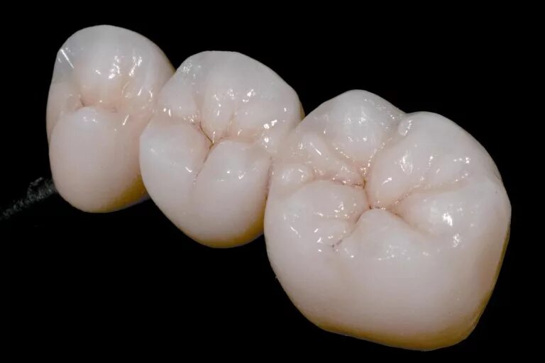 perfect composite carving - YouTube