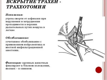 Трахеотомия