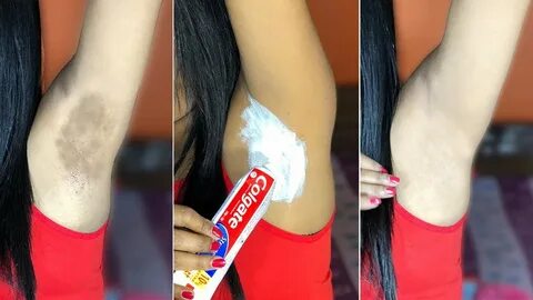 Как осветлить кожу подмышек