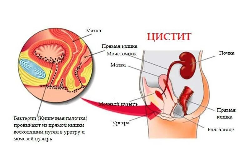 Почему У Девушки Болит Влагалище После Секса