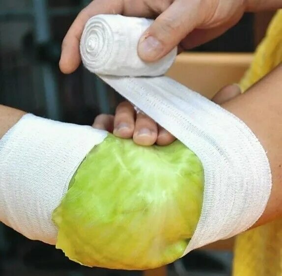 Капустный лист при артрозах. Капустный лист при артрозах