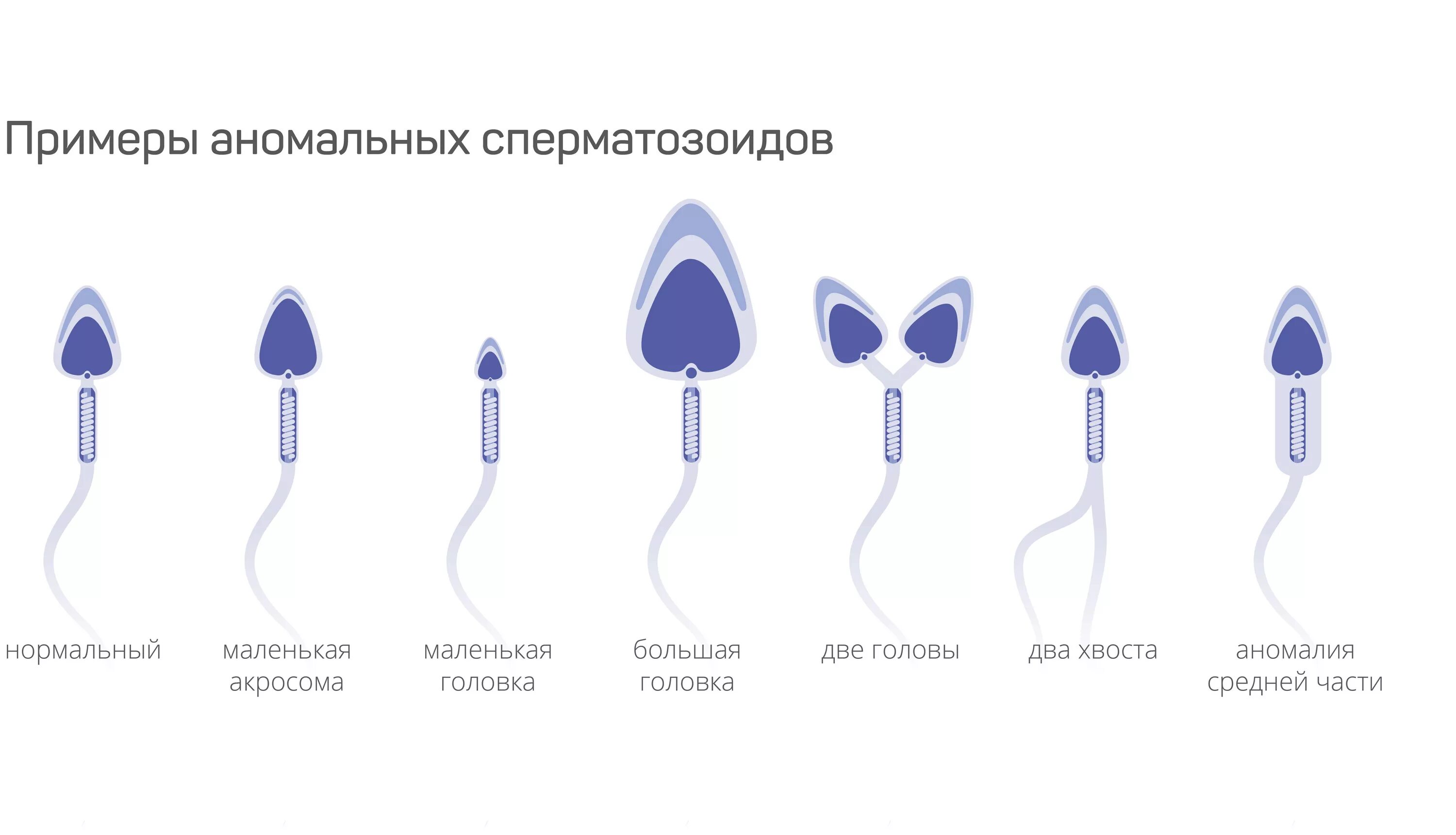 Что будет если кончить в мужчину. Нормальные и патологические формы сперматозоидов. Морфология сперматозоидов: аномалия головки. Тератозооспермия патологии сперматозоидов. Спермограмма с аномальными сперматозоидами.