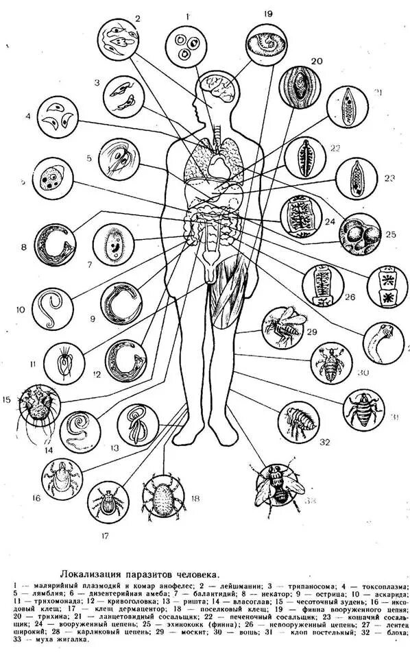 Схема локализации паразитов в организме человека. Локализация паразитов человека. Локализация паразитических простейших в организме человека. Паразиты на схеме тела человека. Строение внутренних паразитов